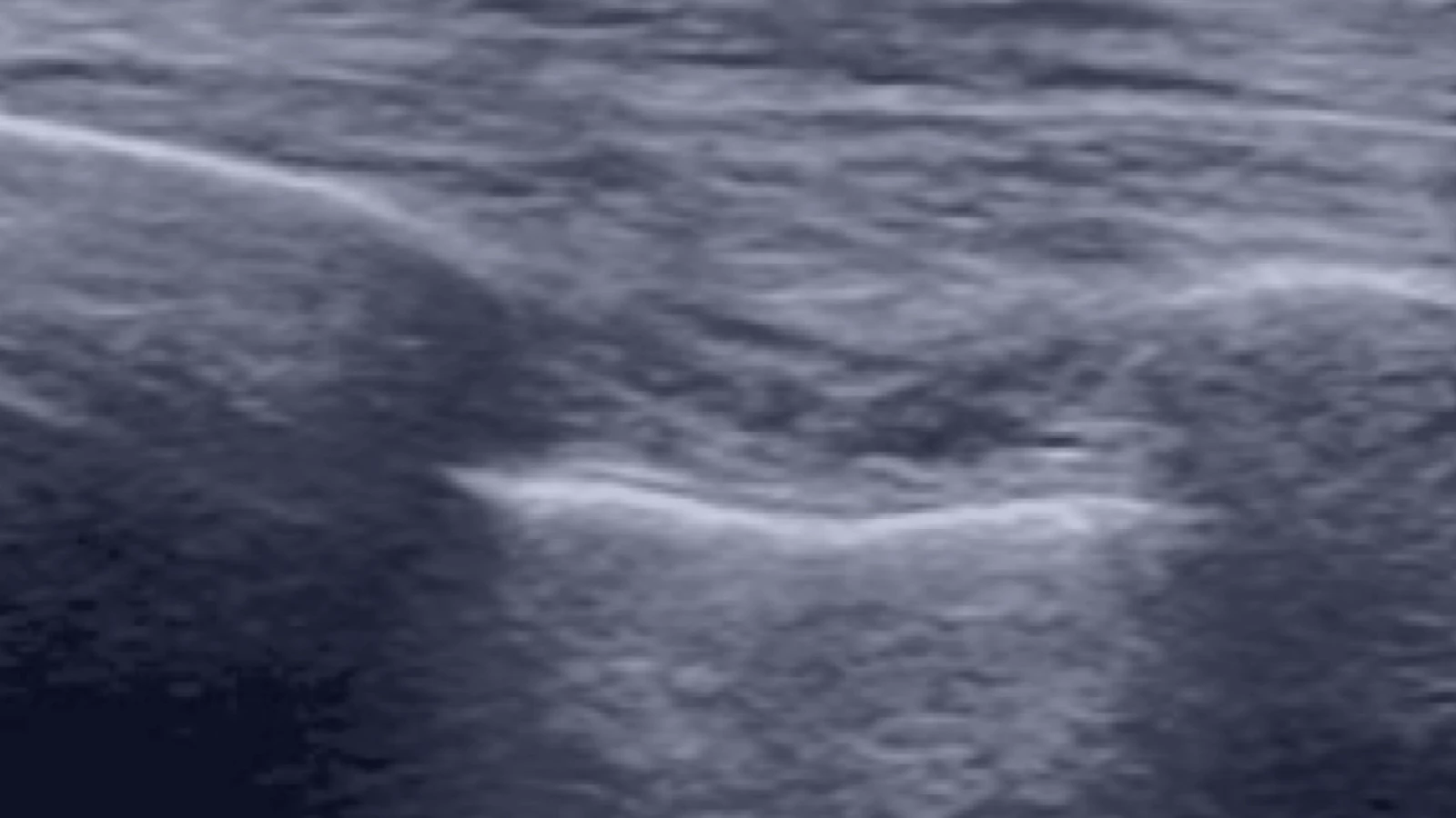 Online onderwijs longechografie icu.nl