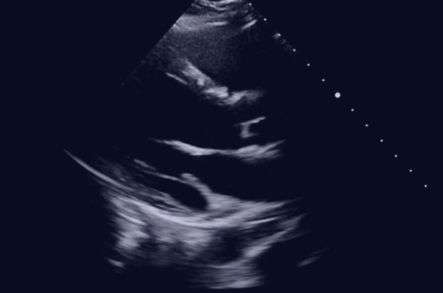 Online onderwijs hartechografie icu.nl