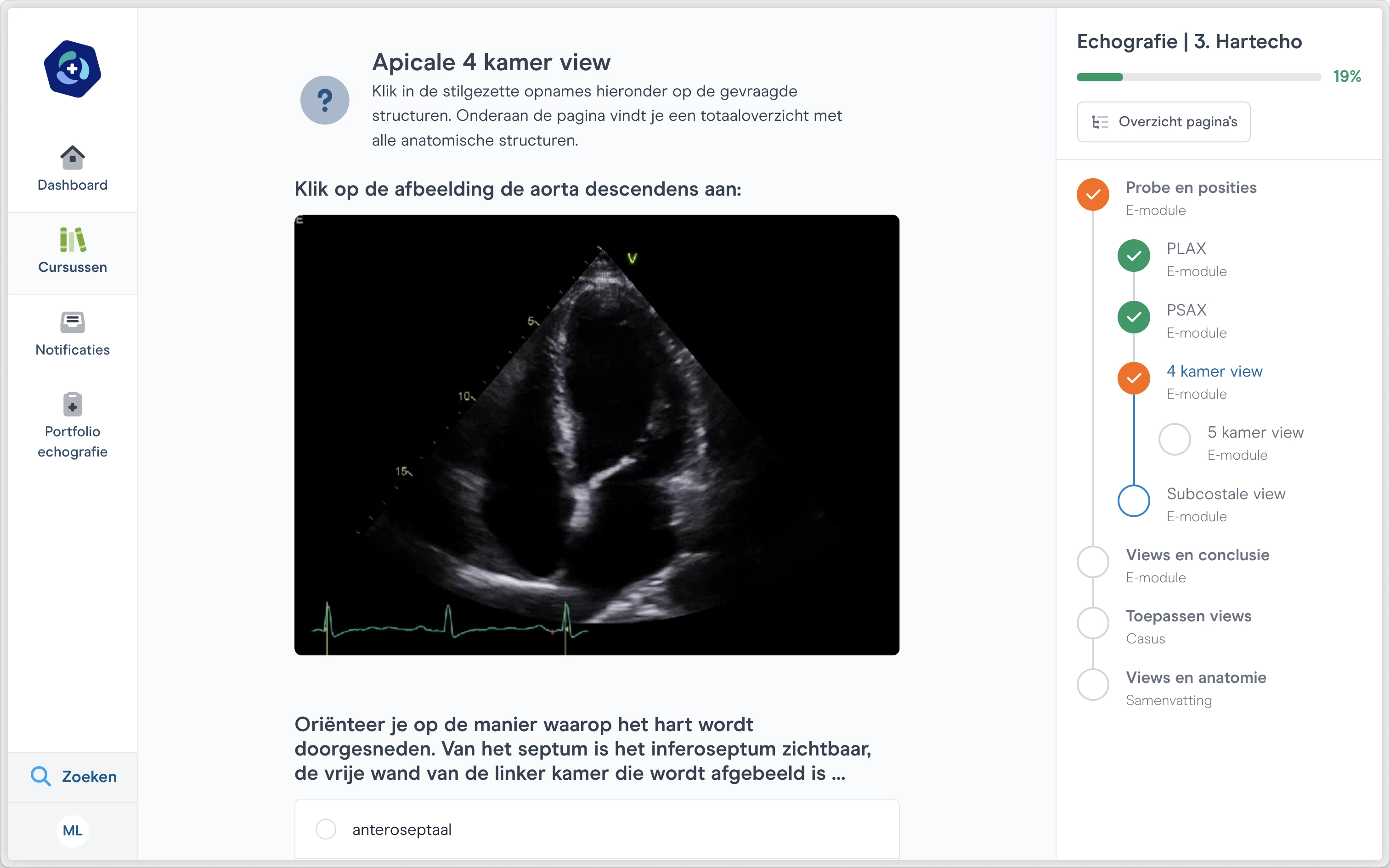 screenshot 4 kamer view hartecho