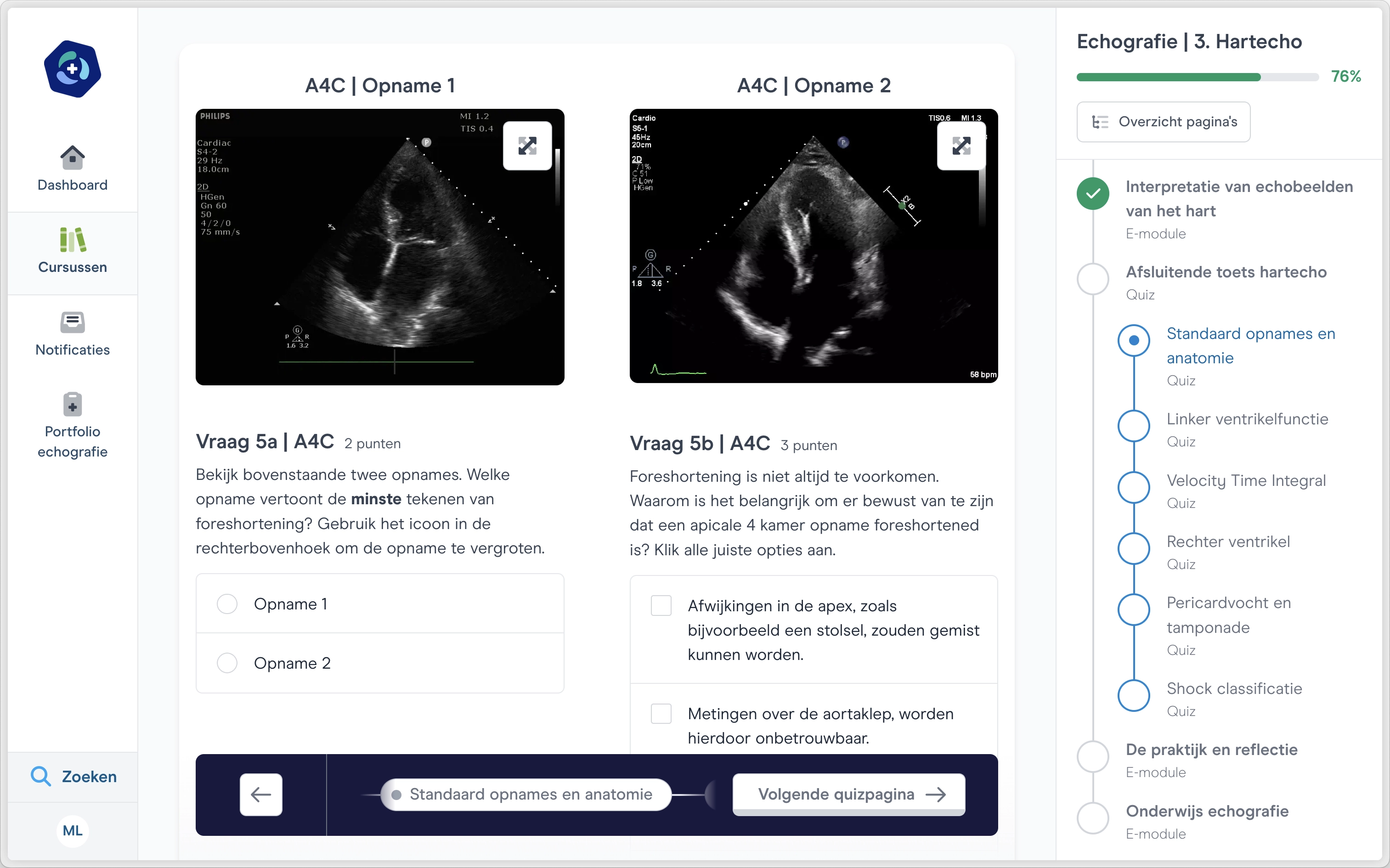 screenshot toets hartecho