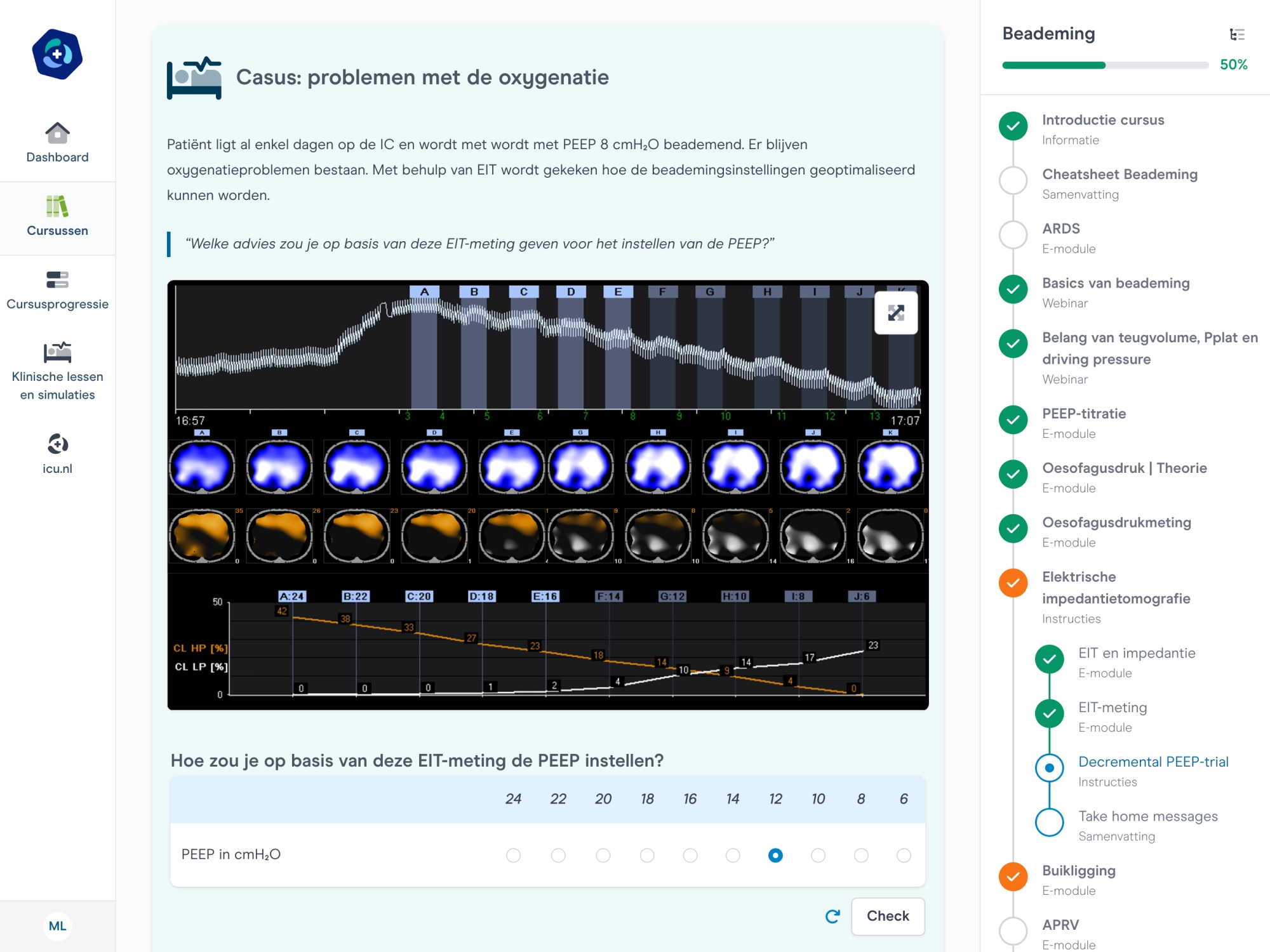E-learning en cursus over beademing, peep en long-protectief beademen op de IC